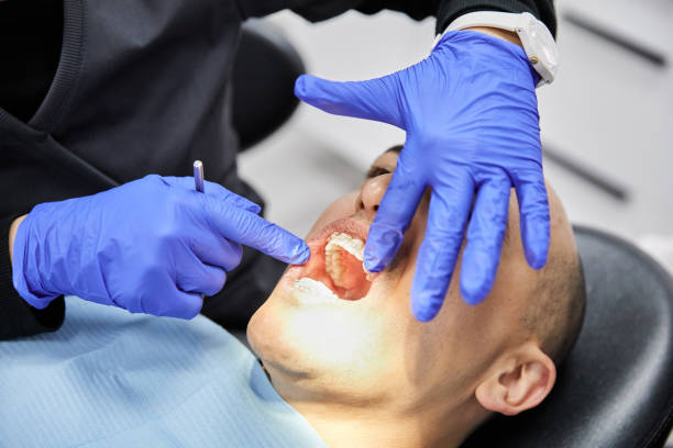 Best Emergency Dental Extractions in Warrensville Heights, OH